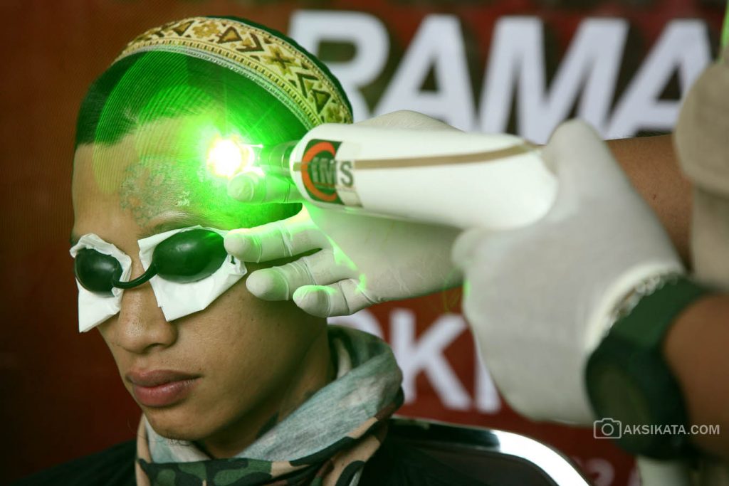 Hapus Tato Gratis - Kuncoro Widyo Rumpoko 00